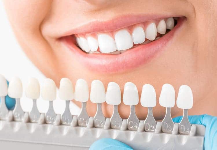 A woman smiling as she compares dental crown shades to choose the one that matches her teeth