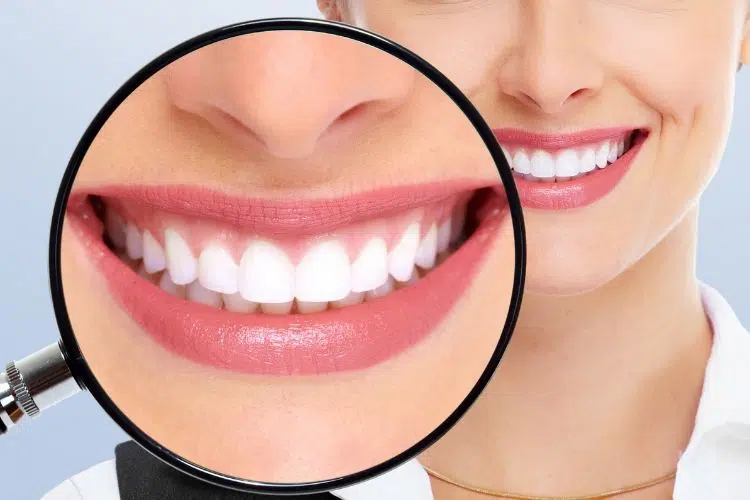 Everything You Need to Know About Whitening Your Teeth How to Keep your teeth healthy with nutrition