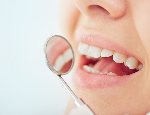 How to Keep Your Teeth Healthy: 6 Non-Negotiable, Daily Habits To Maintain Optimal Oral Health