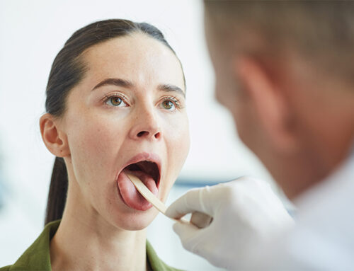 Roof Of Mouth Yellow? 6 Signs You Should Worry