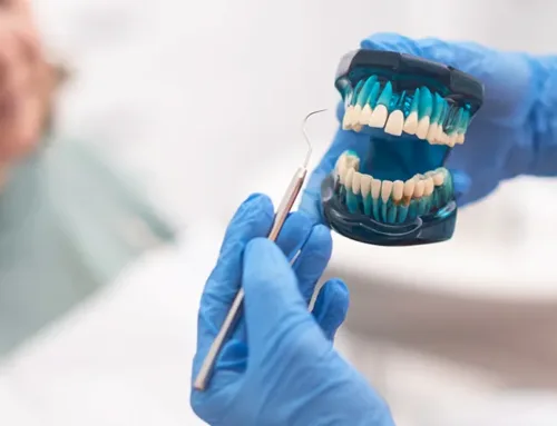 3 Types of Cavities We Deal With The Most in Tampa