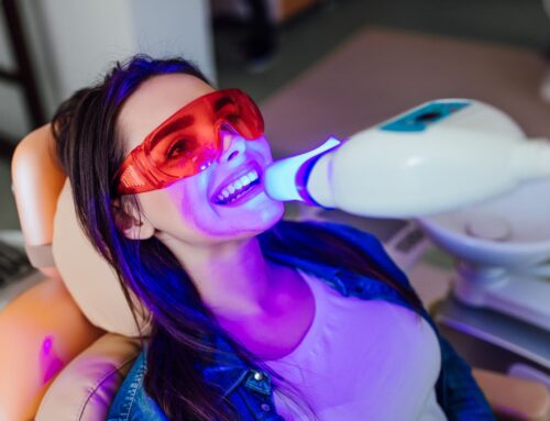 Brighten Your Smile: Pro vs DIY Teeth Whitening