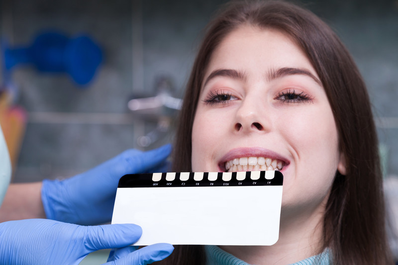 Are You a Good Candidate for Veneers?