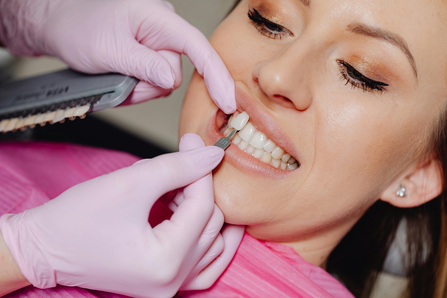 What to Expect During the Veneer Procedure