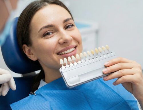 Porcelain vs Composite Veneers: Which is Best?
