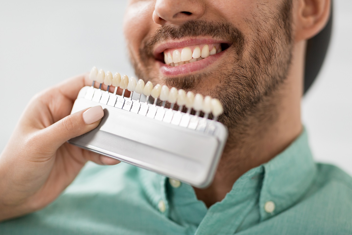 How Long Do Veneers Last? Care & Maintenance Tips